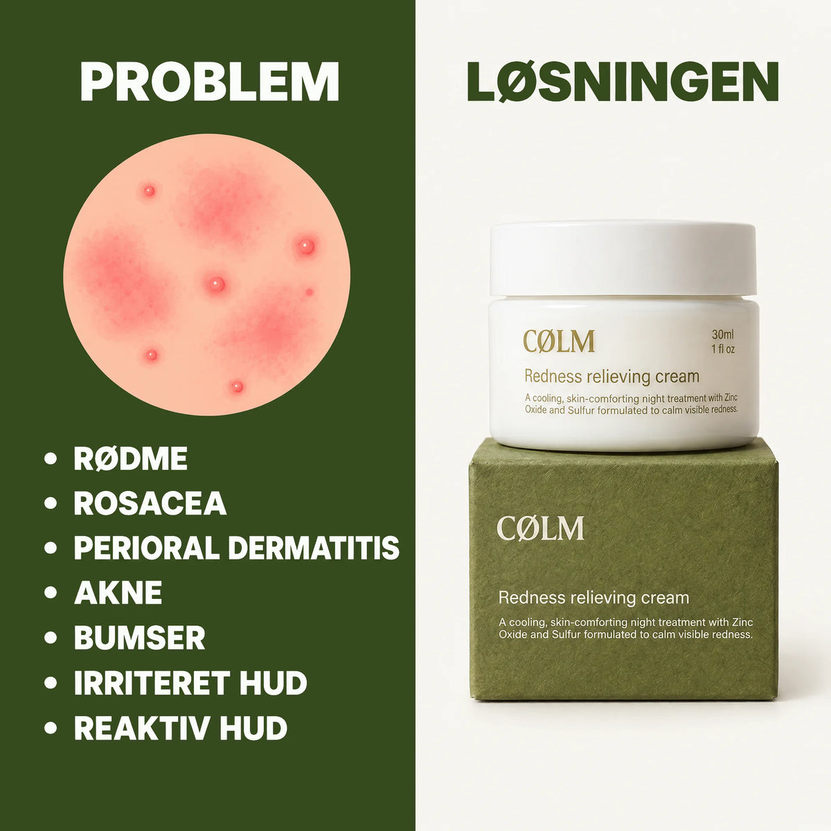 Problem og løsning: rødme, rosacea, perioral dermatitis og bumser til venstre – CØLM Redness Relieving Cream på sin grønne æske til højre.
